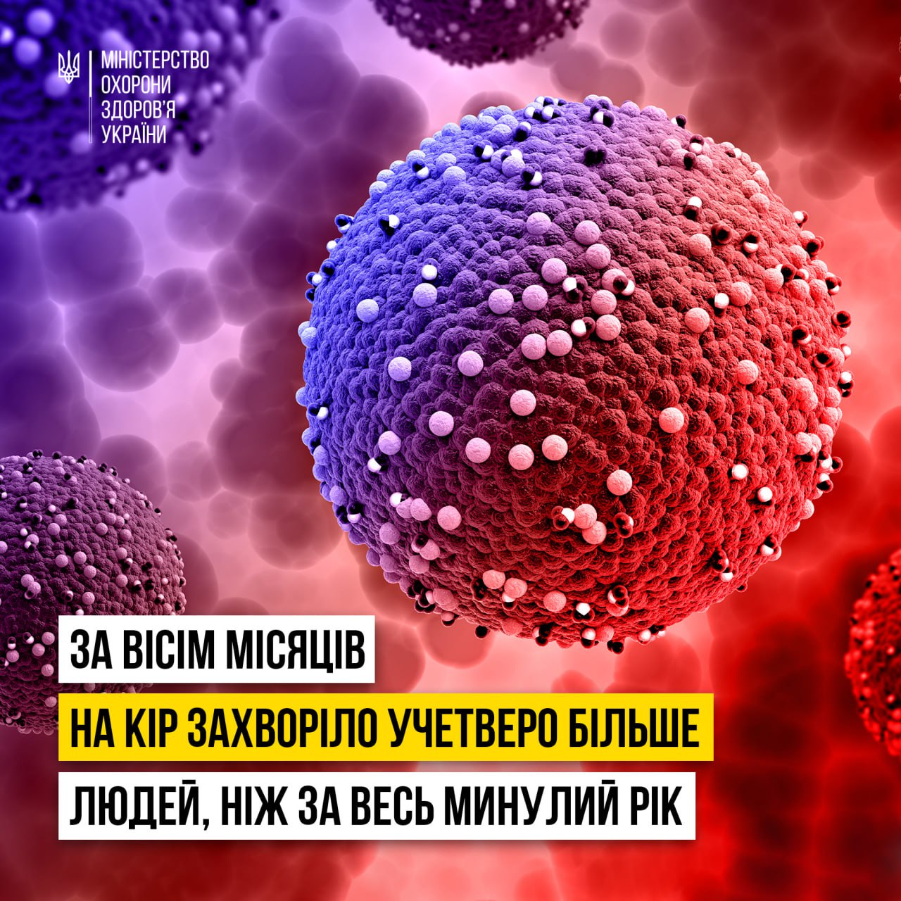 За вісім місяців на КІР захворіло учетверо більше людей, ніж за весь минулий рік